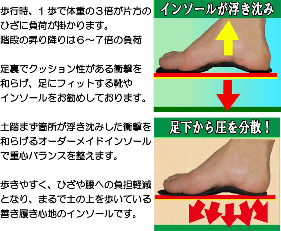 腰痛、ひざ痛にオーダーメイドインソールが効果を発揮します。