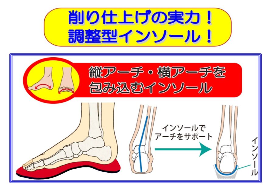 不安定なバランスをインソールで改善